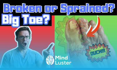 Broken Big Toe or Sprained Big Toe Joint BEST Home Treatment 2022