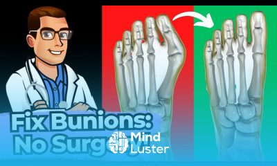 Bunion Home Cure WOW Stretches Exercises Correctors NO Surgery