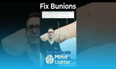 Acupuncture for Bunions Worth It How to Get Rid of Bunions