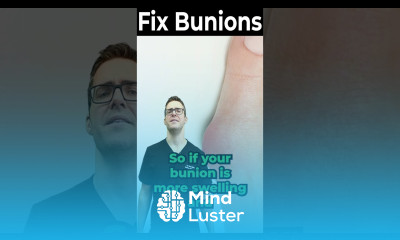 Bunion Pain Relief with Medication NSAIDs Steroids Creams