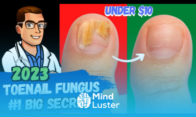 BEST Toenail Fungus Treatment 2024 4 BIG SECRETS
