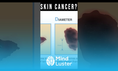 What Does Skin Cancer Look Like Symptoms Pictures Types