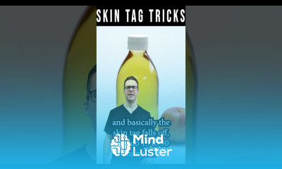 How To Get Rid Of Skin Tags Wart Removal Apple Cider Vinegar