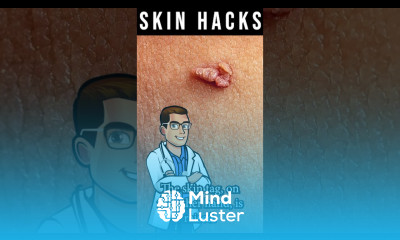 Calluses vs Corns vs Warts vs Skin Tags Diagnosis Pictures