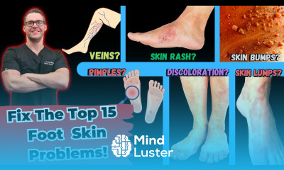 Top 15 Foot Skin Problems Toenail Fungus Dry Skin More