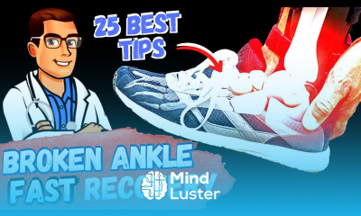 BEST Ankle Fracture Broken Ankle Recovery Time 2024 25 BEST TIPS