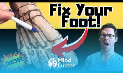 Broken Foot Recovery Foot Fracture Home Treatments Top 25 Hacks