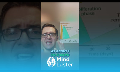 How long does a twisted ANKLE last how long can swelling last