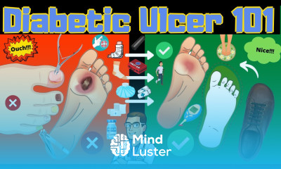 Diabetic Foot Ulcer Foot Wound 101 STOP Diabetic FOOT Infections