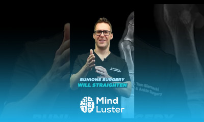 What s a BUNION vs Big Toe Joint vs Arthritis Bunion Shoes Bunion Support