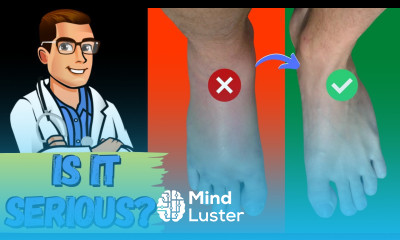 How To Tell If My Foot or Ankle Injury is BAD Sprained or BROKEN