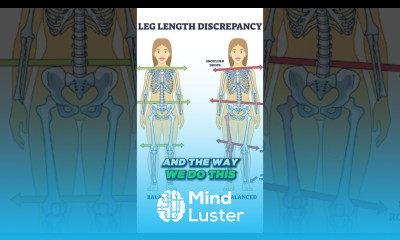 Best ASO Ankle Brace Sprained Ankle Brace Ankle Support Brace