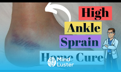 High Ankle Sprain Treatment Causes Best Recovery Time 2022