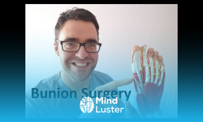 Bunion Surgery Recovery What to expect with bunionectomy surgery