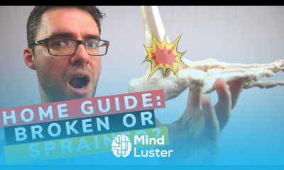 Broken Ankle or Sprained Ankle How to Know 2022 Doctor Guide