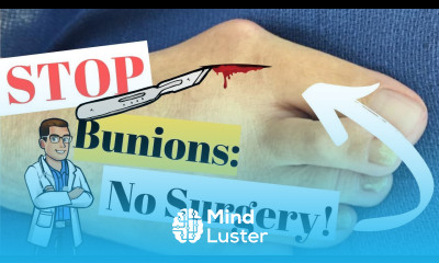 Bunion Home Treatment Top 7 Bunion Correctors Splints Gel Pads