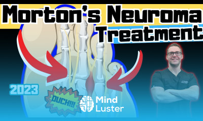 Morton s Neuroma Home Treatment NO Surgery For Foot Neuromas