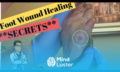 5th Toe Treatment of a Diabetic Foot Wound Pain Free