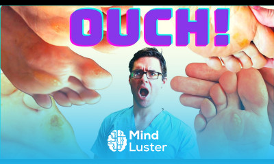 Plantar Warts vs Corns vs Calluses TOP 20 BEST Home Remedies