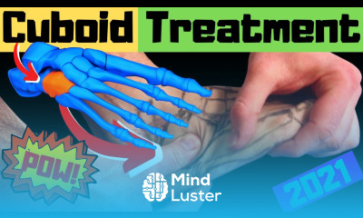 Cuboid Syndrome Self Treatment Cuboid Bone Outside of Foot Pain