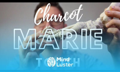 Charcot Marie Tooth Disease Best Foot Treatment 2022