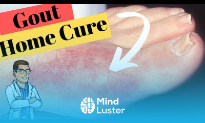 Gout Big Toe Joint Treatment BEST Home Remedies 2022