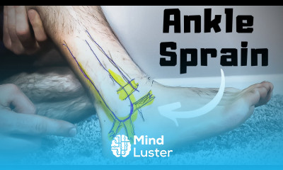Twisted or Rolled Ankle Sprain Treatment FASTER Home Recovery Time