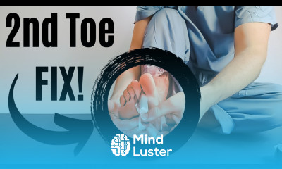 Second Toe PAIN Plantar Plate Tear INJURY Taping BEST Treatment