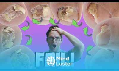 20 Ways To Get Rid of Toenail Fungus Proven CURE Home Remedies