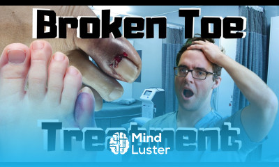 Broken Toe Fracture Treatment SHOULD I See A Doctor