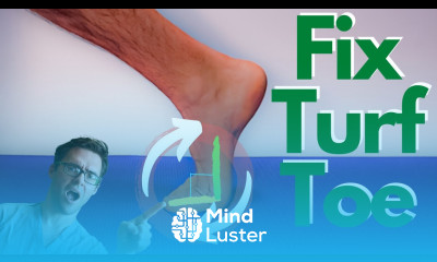 Turf Toe Injury BEST Treatment Causes Symptoms 3 Grades