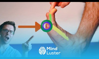 BEST Sesamoiditis Treatment Sesamoid Bone Pain Fracture FIX