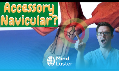 Accessory Navicular Bone Pain Inside of Foot Pain Inside of Arch