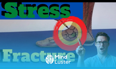 Navicular Stress Fracture Treatment 2022 Exercise Shoes Stretches