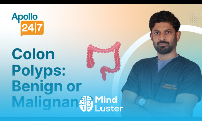 Are Colon Polyps Cancerous Dr Raghu D K