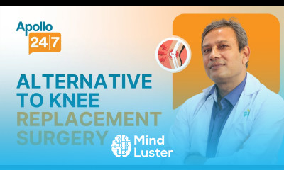 How Long is the Recovery from Having a Knee Replacement Dr Manabendra Nath Basu Mallick