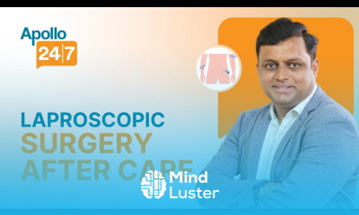 Do s Don ts After Laparoscopic Surgery Dr Kiran KJ