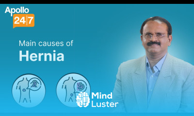 Causes of Hernia Dr Prashanth C Apollo 24 7