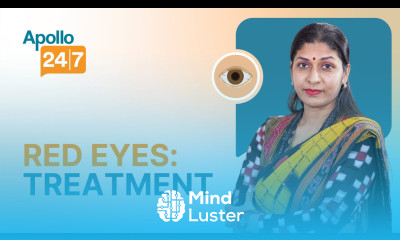 Treatment For Red And Itchy Eyes Dr C K Deepa