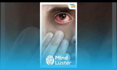 Is Pink Eye Always Conjunctivitis Dr Abhishek Hoshing Apollo 24 7