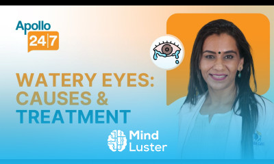 How do I Stop my Eyes from Watering Dr Shubhra Goel