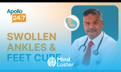 Swollen Ankles Feet Causes and Cure Dr S K Sahoo Apollo 24 7