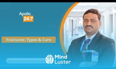 What Are the Different Types of Fractures Dr Narendar Dasaraju