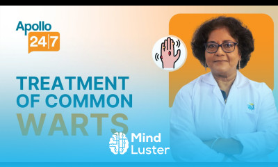 How to Get Rid of Warts Masse Dr Srabani Ghosh Zoha