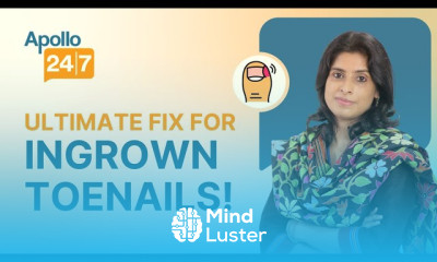 How to Fix Ingrown Toenail Dr Monika Rajpal