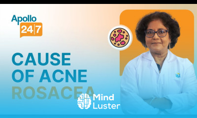 Does Facial Blushing Rosacea Go Away Dr Srabani Ghosh Zoha