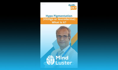 What Is Hypopigmentation Dr Ravichandran G