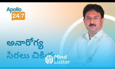 Treating Varicose Veins in Telugu అనారోగ్య సిరలు చికిత్స Dr Chandra Sekhar Chevuturu