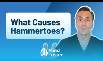 What Is The Main Cause of Hammertoes