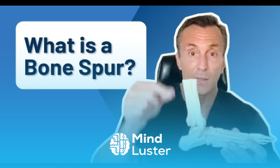 What Is a Bone Spur Identifying Foot Pain Problems